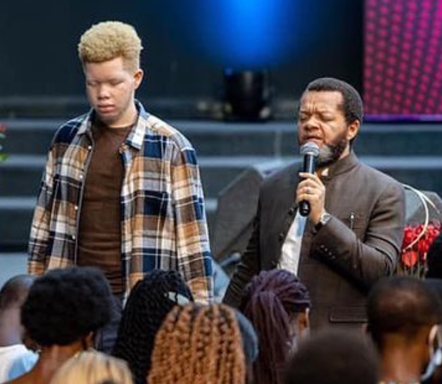 Jai Deux Enfants Albinos Et Deux Enfants Qui Ne Le Sont Pas Pasteur Marcello Tunasi Bromyfa 